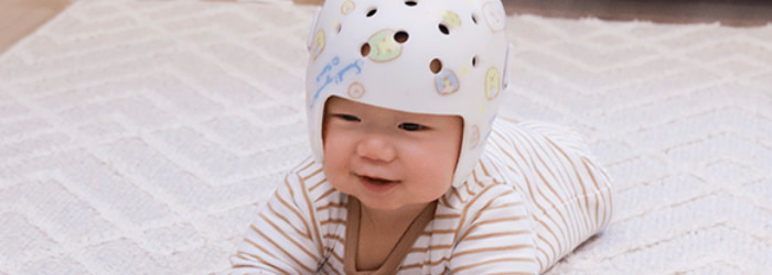 赤ちゃんの頭のかたち外来